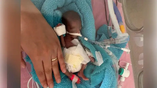 Baby Rüzgar, born at 350 grams in Aydın, discharged after 240 days