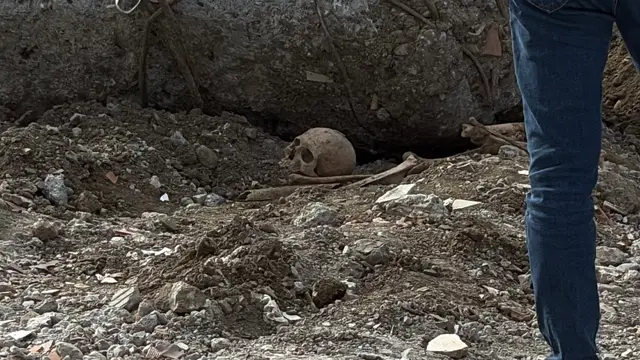 Human skull and bone fragments found during school demolition in Çorum